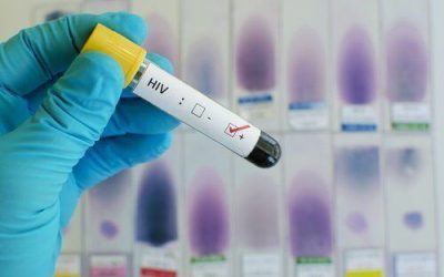 Treating HIV/AIDS With Medical Marijuana