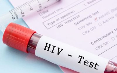 Does Medical Marijuana Treat HIV/AIDS in Ohio