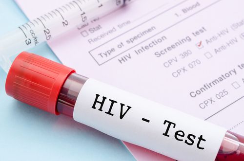Does Medical Marijuana Treat HIV/AIDS in Ohio
