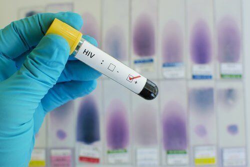 Treating HIV/AIDS With Medical Marijuana