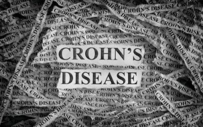 Treating Crohn’s Disease with Medical Marijuana