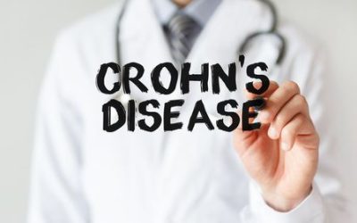 How Medical Marijuana Treats Crohn’s Disease in Ohio