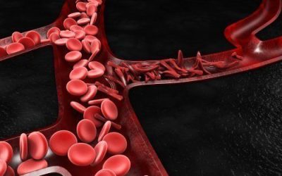 Medical Marijuana Benefits Individuals with Sickle Cell Disease