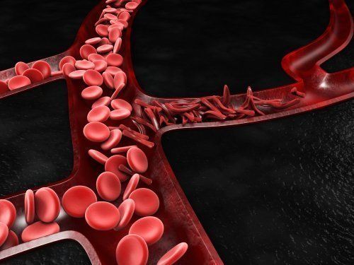 Medical Marijuana Benefits Individuals with Sickle Cell Disease