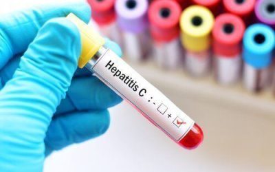 Medical Marijuana for Hepatitis C