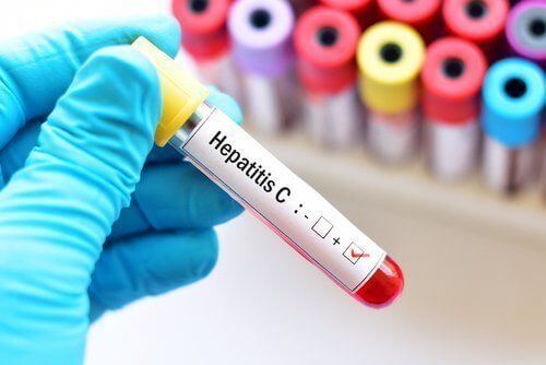 Medical Marijuana for Hepatitis C