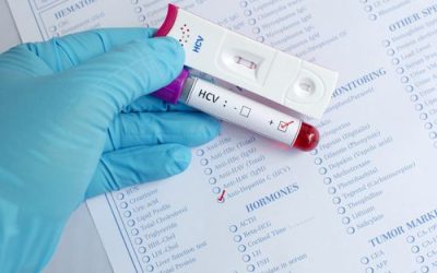 Medical Marijuana for Hepatitis C in Ohio