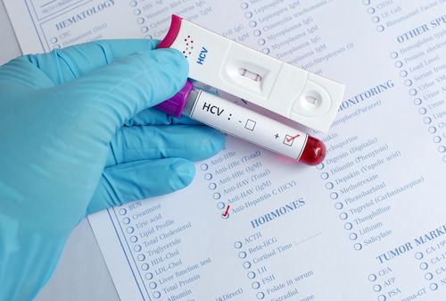 Medical Marijuana for Hepatitis C in Ohio