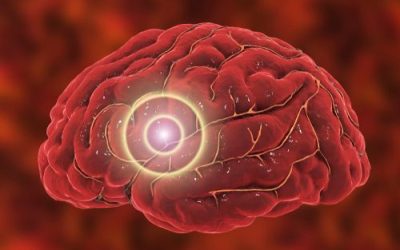 Brain Inflammation May Be Reduced with CBG in Cannabis in Ohio