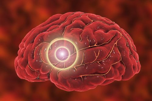 Brain Inflammation May Be Reduced with CBG in Cannabis in Ohio