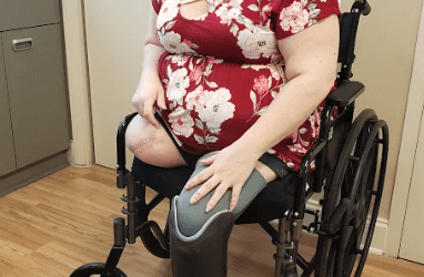 Double Amputee Says DocMJ & Medical Cannabis Has Made Life Better