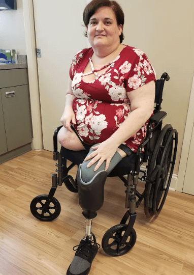 Double Amputee Says DocMJ & Medical Cannabis Has Made Life Better