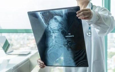 August is Spinal Muscular Atrophy Awareness Month: Here’s How Medical Marijuana Can Help SMA Patients in Ohio