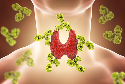 Can an Ohio Medical Marijuana Card Help Those Suffering From Thyroid Disorders?