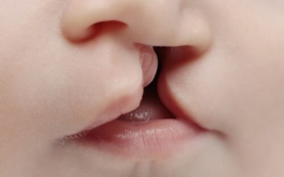 Does Cannabis Use Contribute to Birth Defects?
