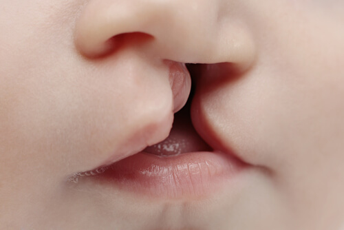 Does Cannabis Use Contribute to Birth Defects?