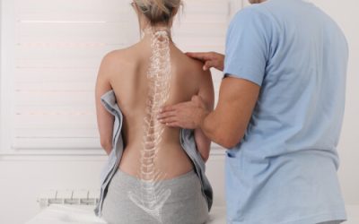 Can Medical Marijuana Help People With Scoliosis?