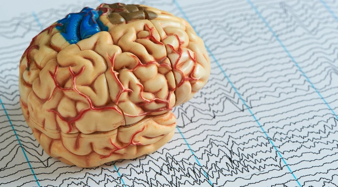Cannabis and Epilepsy: A Growing Hope for Families in Florida and Around the World