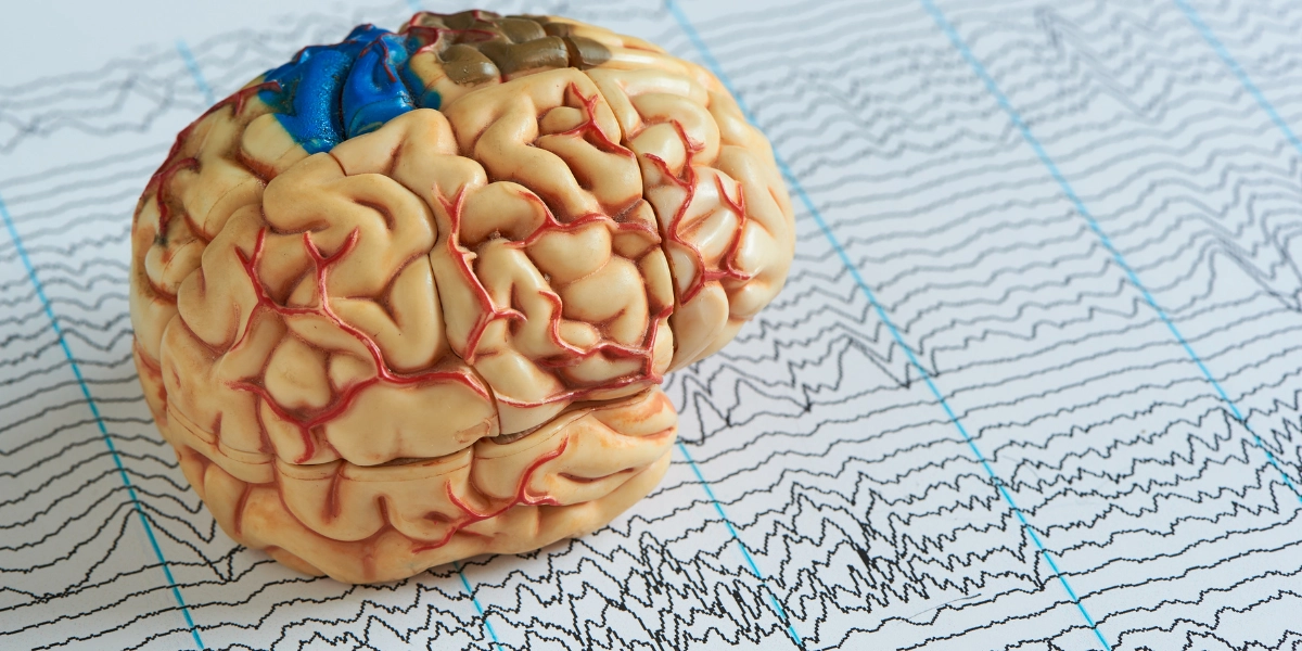Cannabis and Epilepsy: A Growing Hope for Families in Florida and Around the World